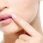 Come combattere l’Herpes labiale con rimedi naturali