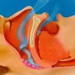 Come curare le apnee notturne, una ricerca canadese mostra una nuova soluzione