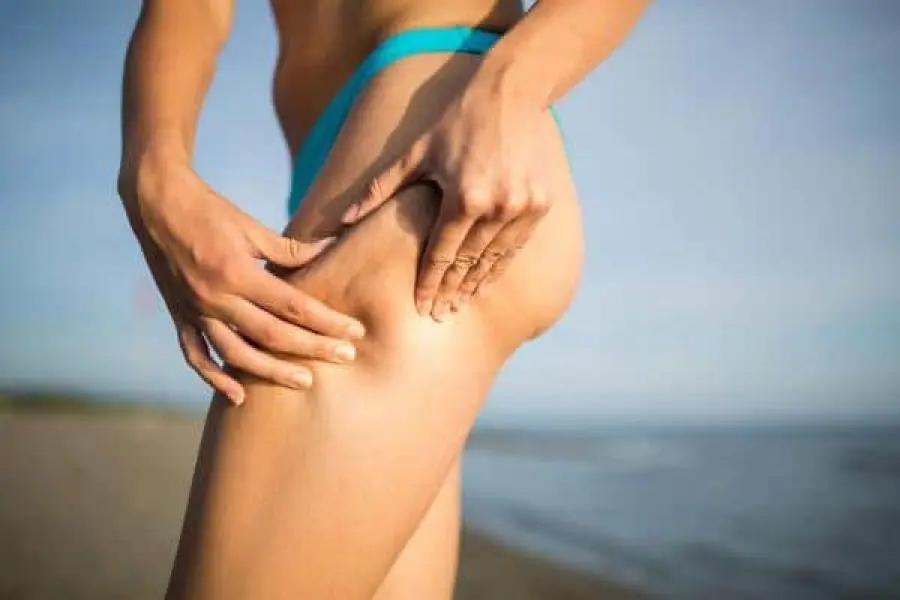 Dieta anti cellulite: i consigli migliori