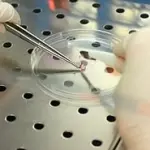 Al via il progetto Mesems per la cura della Sclerosi multipla