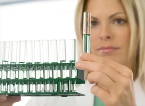  I fattori che determinano creatinina bassa