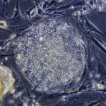 Cellule staminali: visione discordanti di due mondi diversi