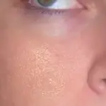 Maschera contro i pori dilatati naturale