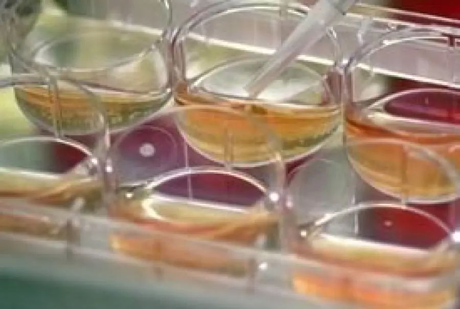 Continua la questione 