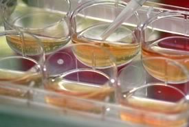 Continua la questione 